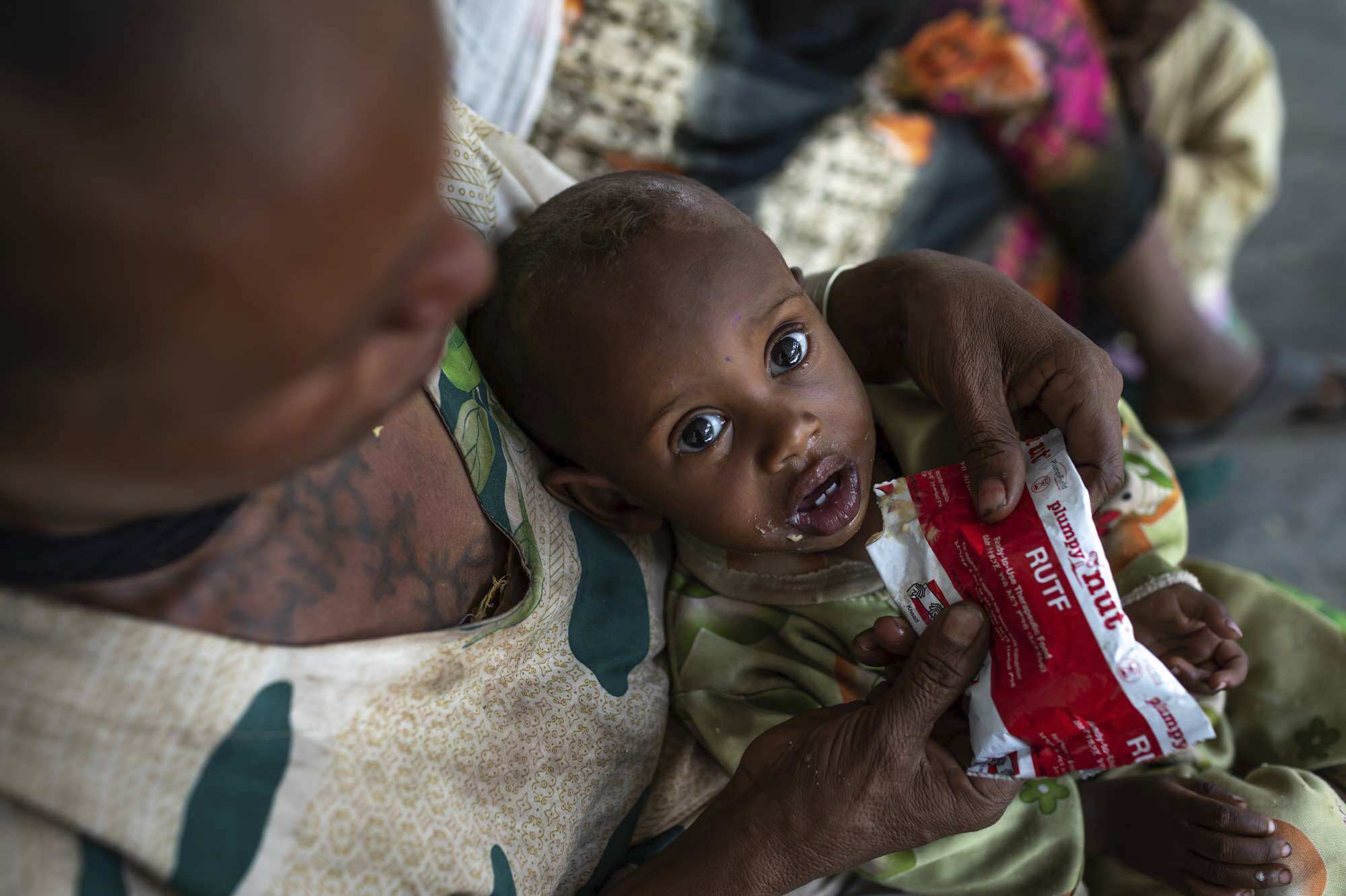 UN estimates 9.4 million people need food aid in northern Ethiopia