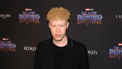 Shaun Ross Christopher Smith / Invision / AP