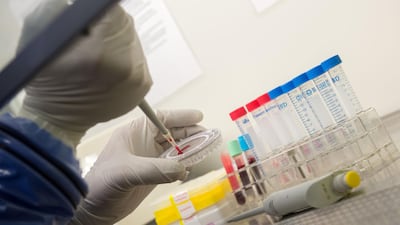 Rapid and sweeping advances have been made in the treatment of cancer in recent years, meaning that living through the disease is now increasingly normal. AFP