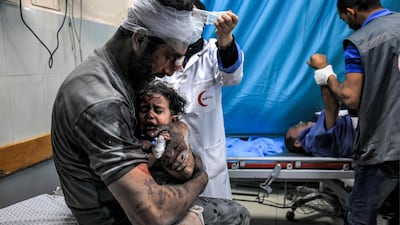Survivors of Israeli bombardment at a trauma ward at Nasser Hospital in Khan Younis in the southern Gaza Strip. AFP