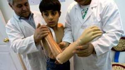 Ahmed Abdul Aziz, 10, from Janin, West Bank, lost his arm at the age of three, while playing with an olive oil press at home.