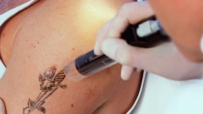 Certain jobs require people to remove tattoos, says a Dubai doctor. Corbis