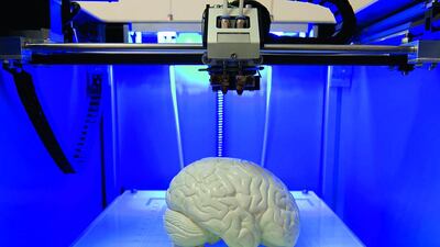 3-D printers have revolutionised health care. Seen here, a printed model of a brain.