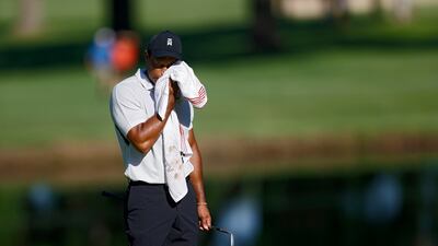 Tiger Woods wipes his face on the 11th green during a practice round for the PGA Championship. AP