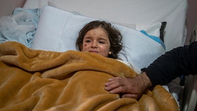 Zeinab Taleb being treated for injuries after an Israeli air strike, at Jabal Amel Hospital in Tyre, Lebanon. Getty Images