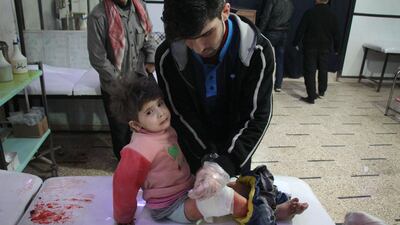 A wounded Syrian girl receives treatment at a makeshift hospital following reported air strikes on the rebel-held besieged town of Douma in Eastern Ghouta. AFP