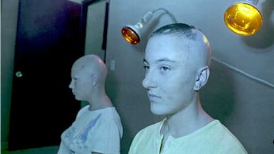 Oxana Gaibon (R), 17, and Alla Kozimierka, 15, both victims of the 1986 Chernobyl nuclear disaster, receive infrared radiation treatment on December 12, 1994 at the Tarara Children Hospital in Havana, Cuba, as along with hundreds of other contaminated Russian and Ukranian adolescents they have been receiving free medical treatment in Cuba as part of a humanitarian project. AFP