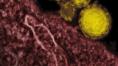 An undated electron microscope image made available by the National Institute of Allergy and Infections Diseases - Rocky Mountain Laboratories shows novel coronavirus particles, also known as the Mers virus, colourized in yellow. The mysterious new respiratory virus originated in the Middle East. AP Photo