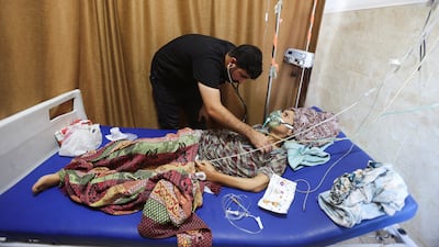 A Palestinian doctor puts an oxygen mask on a patient amid shortages of fuel needed to run generators, at Nasser Hospital in Khan Younis, southern Gaza. Reuters