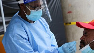 A health worker takes a swab from a man to test for Covid-19 coronavirus outside a makeshift clinic in a sports stadium in Port Moresby in Papua New Guinea. AFP