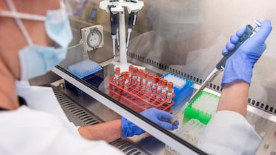 Samples of the University of Oxford coronavirus vaccine trials are handled at a laboratory. AP