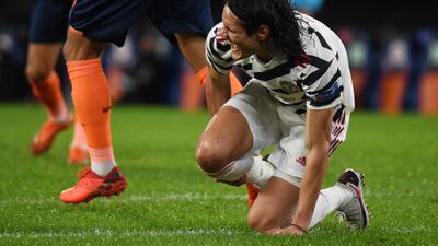 Edinson Cavani of Manchester United goes down injured. Getty