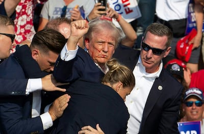 Republican candidate Donald Trump's ear was grazed during the shooting in Butler, Pennsylvania on July 13. AFP