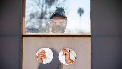 Daisy Ozaeta, 25, of Los Angeles, waits for Dr. Nana Afoh-Manina, co-founder of myCovidMD, to collect a blood sample from her for a Covid-19 antibody test. AP Photo