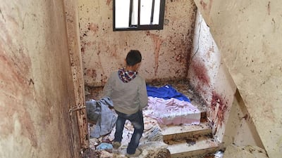 A boy walks down a staircase with splashed blood on the walls of a staircase caused by an explosion inside a building in Deir Ammar town, northeast from the city of Tripoli, Lebanon on December 5. Reuters