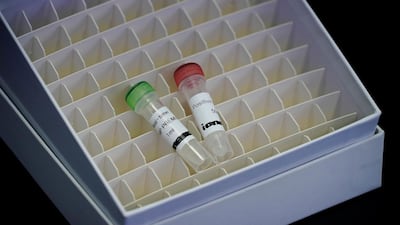 Samples of iLAMP Novel-Coronavirus Detection Kit are seen during a demonstration at an iONEBIO's office in Seongnam. Reuters