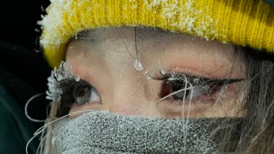 The 2022 Winter Olympics are being held under strict Covid-19 containment conditions. AP