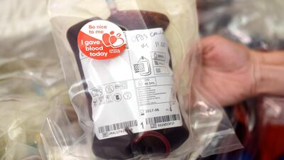 An inquiry opened Monday to examine the scandal of contaminated blood in the British public health system. EPA