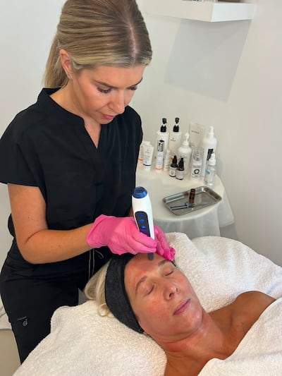 Sophie Milnes says a non-invasive microneedling treatment involves microscopic spicules derived from sea sponges. Photo: Sophie Milnes