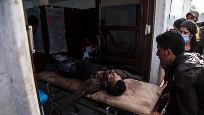A man wounded in Turkish shelling is brought to Tal Tamr hospital in north Syria. Syrian government troops moved into towns and villages in northern Syria on Monday, setting up a potential clash with Turkish-led forces advancing in the area as long-standing alliances in the region begin to shift or crumble following the pullback of U.S. forces. AP Photo