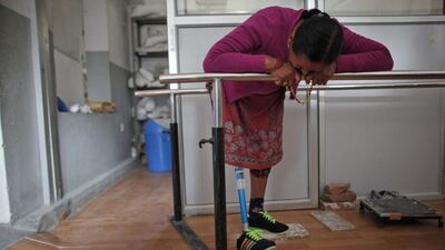 Daan Maya Maharjan, 47, who lost a leg in the April 25 earthquake, looks at her prosthetic while practicing to walk with it at a rehabilitation center in Kathmandu, Nepal. Niranjan Shrestha / AP Photo