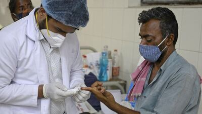 Authorities have not said how many people have died from black fungus. AFP