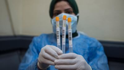 A doctor shows a test kit for coronavirus at the Central Public Health Laboratories in Cairo, Egypt. EPA