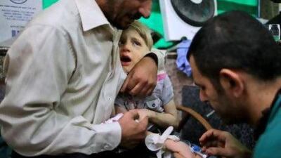 A wounded boy is treated by a doctor in Aleppo, Syria, where the civil war is expected to have a terrible psychological impact on children.