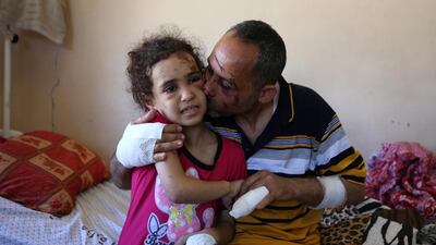 Suzy Ishkontana and her father Riad Ishkontana at Shifa Hospital in Gaza City. AP