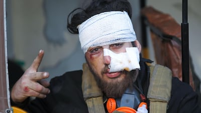 An injured Iraqi protester flashes the victory sign after receiving treatment, amid clashes with security forces during an anti-government demonstration in Al-Khilani square in the capital Baghdad. AFP