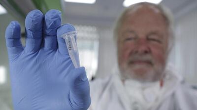 Oxford University genetics professor Bryan Sykes holds a prepared DNA sample taken from hair from a Himalayan animal. Scientists analyzed more than 30 hair samples reportedly left behind by Bigfoot and other related beasts like Yeti and almasty, they found all of them came from more mundane animals like bears, wolves, cows and raccoons. (AP Photo/ Channel 4)