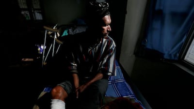 Bishnu Bahadur Karki, 42, looks on as he is sits in an Orthopedic rehabilitation center in Kathmandu, Nepal. Narendra Shrestha / EPA