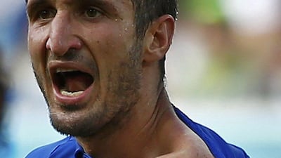 Giorgio Chiellini shows off his shoulder as he appeals to officials after claiming he was bitten by Luis Suarez on Tuesday at the 2014 World Cup. Tony Gentile / Reuters / June 24, 2014