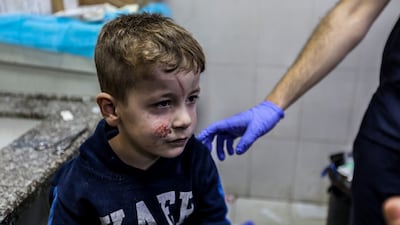 Young children injured in Israeli airstrikes arrive at Nasser Medical Hospital on December 04, 2023 in Khan Yunis, Gaza. Getty