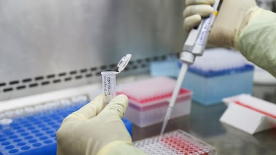 Indian pharmaceutical company Zydus Cadila is among dozens of vaccine candidates being developed globally in the hunt to find an antidote for the coronavirus that has killed more than 1.3 million people. About 30,000 volunteers will receive injections in India next month in final stage trials. Courtesy: Zydus Cadila