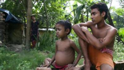 Rimi Haldar, shown here with her older brother Raju, was born with thalassemia and has now contracted HIV and hepatitis B after receiving a transfusion with contaminated blood.