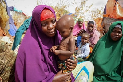 A woman who fled Somalia's drought-stricken Lower Shabelle area holds her malnourished child at a makeshift camp in Mogadishu. AP