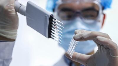 The G20 finance and health ministers have called for collective action to accelerate the research, development, manufacturing and distribution of diagnostic tools and vaccine to combat the Covid-19 pandemic. Xinhua via AP