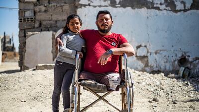 Ahmad Hajj Hmaidy, 36, lost his legs in a 2017 landmine explosion in Raqa, Syria, that also injured his daughter Nada, nine. AFP