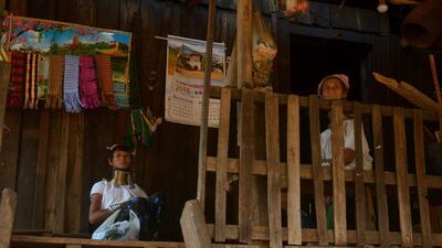 The women can remove their rings with the help of a specialist and their shoulders and collarbones can eventually return to normal, depending on the age at which they are taken off.