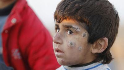 A boy from the Yazidi sect looks on after being delivered to safety in the country’s Kurdish north. Ako Rasheed/Reuters