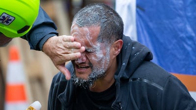A demonstrator receives medial attention after he was pepper sprayed by police. AP