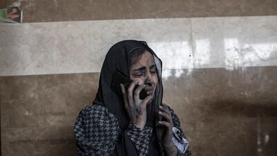 An injured woman speaks on the phone at Nasser Hospital in Khan Younis following Israeli air strikes in the southern Gaza Strip. EPA