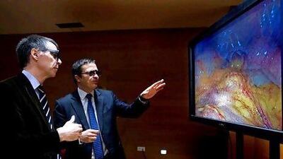 Two people observe a 3D image during the presentation of a new 3D High Definition laparoscopy technology, developed by Clinic Hospital, in Barcelona. Marta Perez / EPA