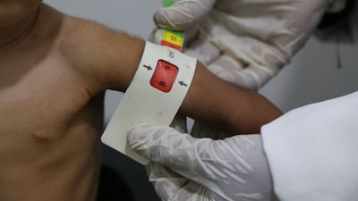 A health worker assesses a malnourished child at a centre in the Khokha district of Hodeidah, western Yemen, in July. AFP