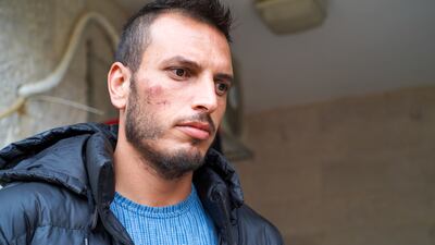 Akram Jundiye, 30, said Israel forces beat him before expelling him to the West Bank. Willy Lowry / The National