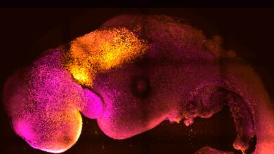 A microscope image provided by researchers shows a synthetic mouse embryo with colours added to show brain and heart formation. Photo: Gianluca Amadei, Charlotte Handford
