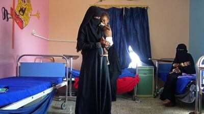A mother holds her malnourished child as they wait for treatment in Al Mutaynah, Tuhayta, Yemen.
