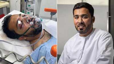 Juma Almheiri was given a one-in-10 chance of survival after his 4x4 was involved in a rear-end collision with a cement lorry in Dubai. Supplied/The National