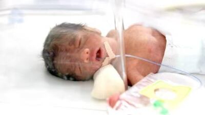 The second baby, an unnamed girl, born of quadruplets to Wafaa Ibrahim and Yaqoob Abdullah.